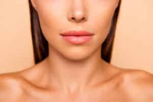 Natural-looking lip filler results with smooth, full lips and enhanced definition.