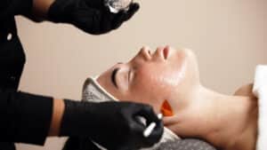 Professional chemical peel facial treatment.