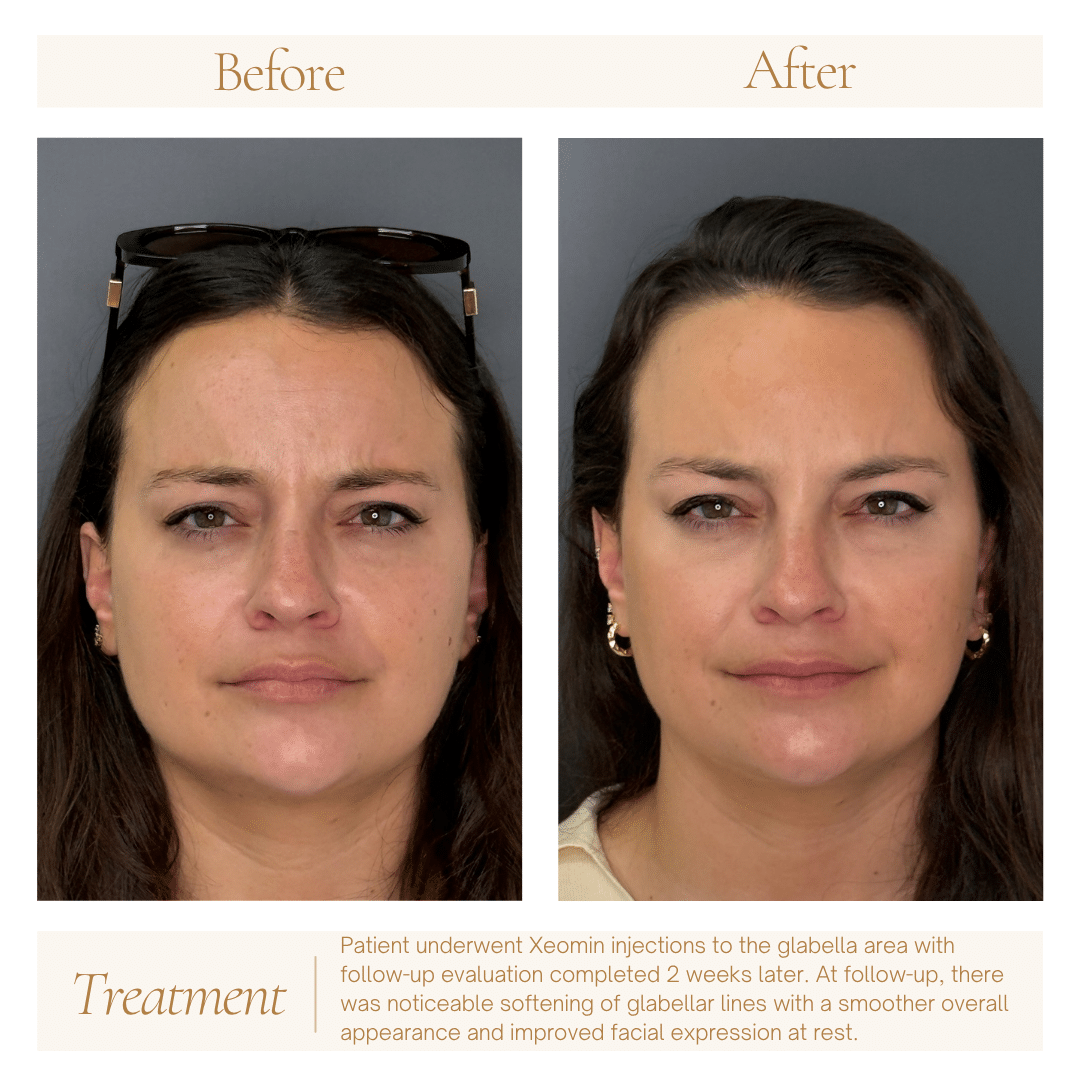 Neutral Before and After Instagram Post (16)